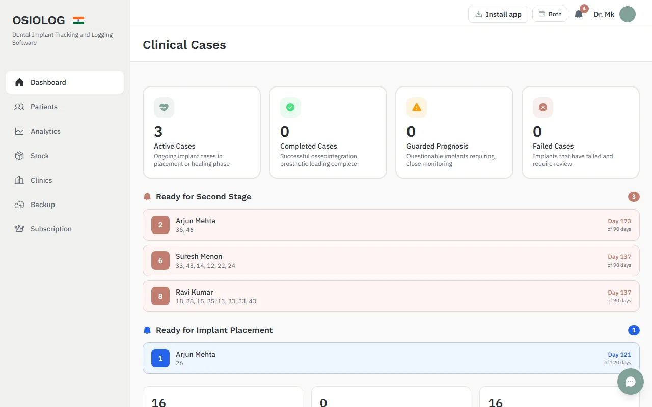 Implant Tracking dashboard with active cases and the patients ready for second stage